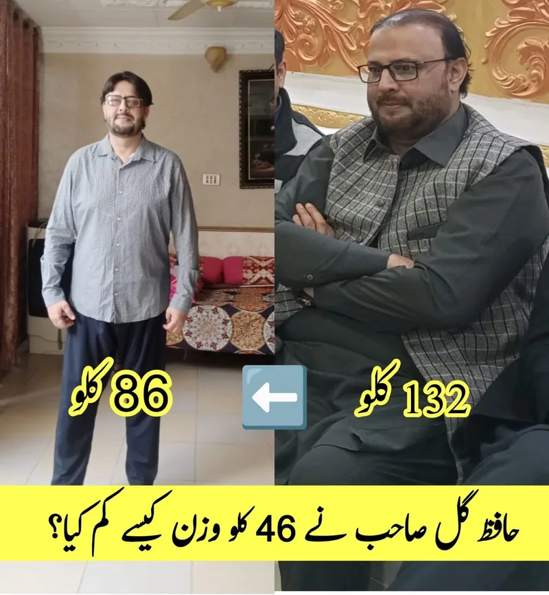 Hafiz Gul Sahib before and after losing 46 kg, from 132 kg to 86 kg, under Dr. Mahboob Ahmad's supervision