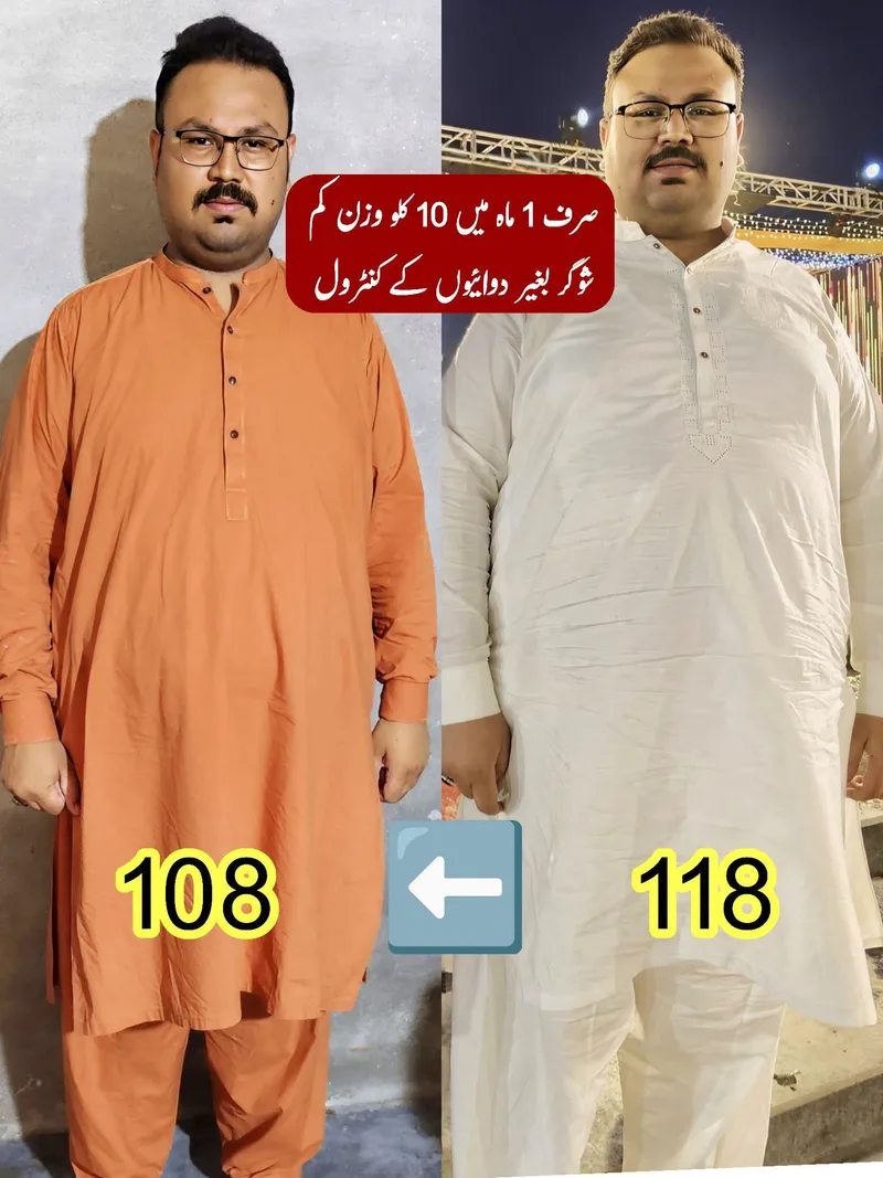 Patient before and after losing 10 kg in one month with sugar controlled without medicines