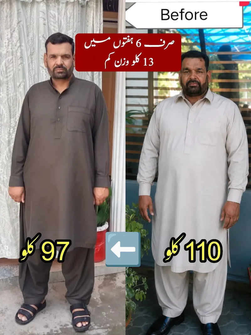 Patient before and after losing 13 kg in six weeks, from 110 kg to 97 kg