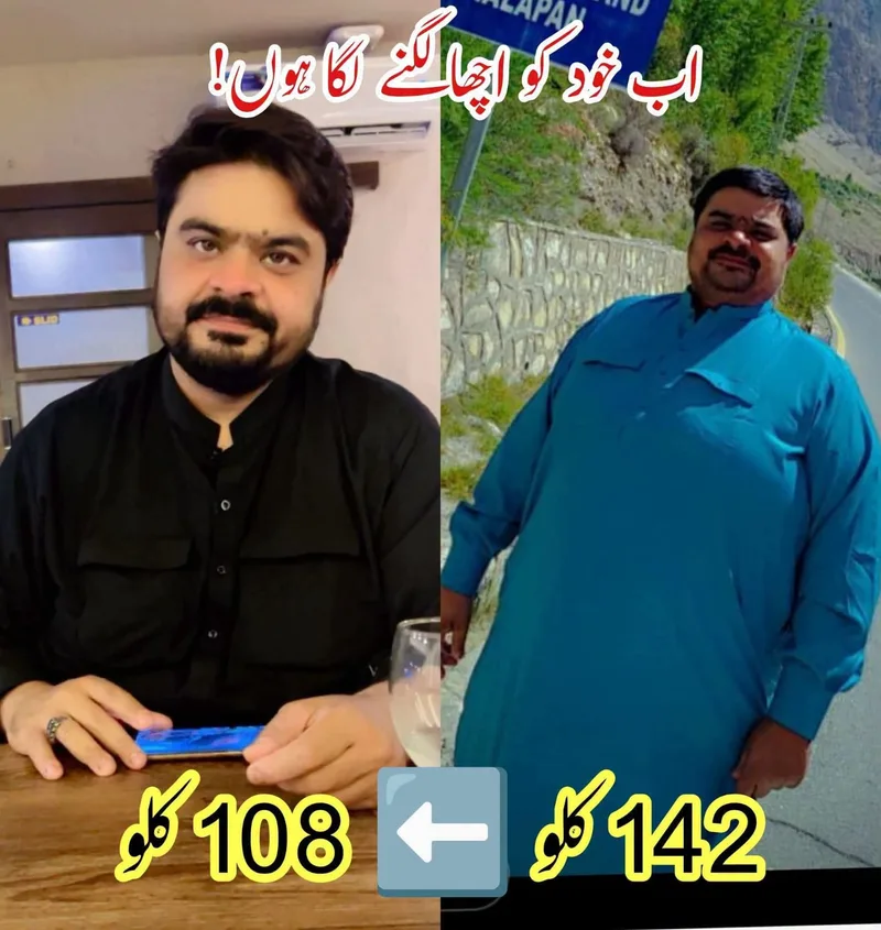 Patient before and after losing 34 kg, from 142 kg to 108 kg, under medical supervision
