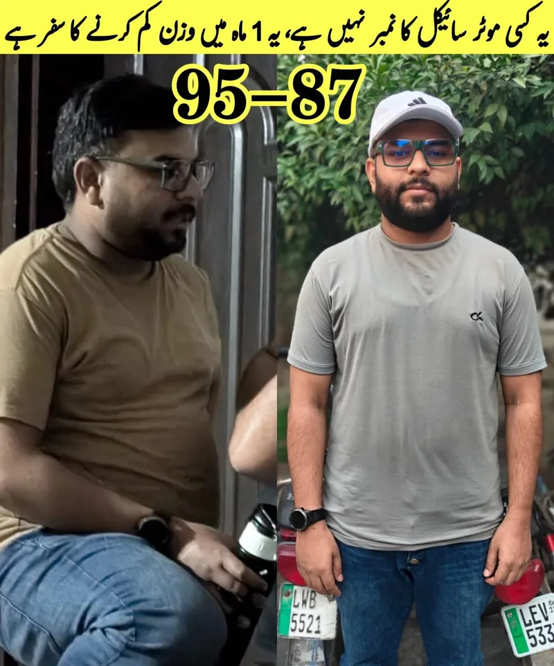 Young patient before and after losing 8 kg in one month, from 95 kg to 87 kg